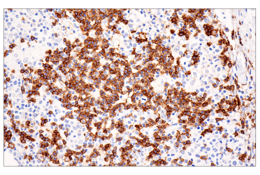 Immunohistochemistry Image 4: CD20 (E7B7T) Rabbit Monoclonal Antibody (BSA and Azide Free)