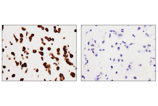 Immunohistochemistry Image 1: SQSTM1/p62 (D6M5X) Rabbit Monoclonal Antibody