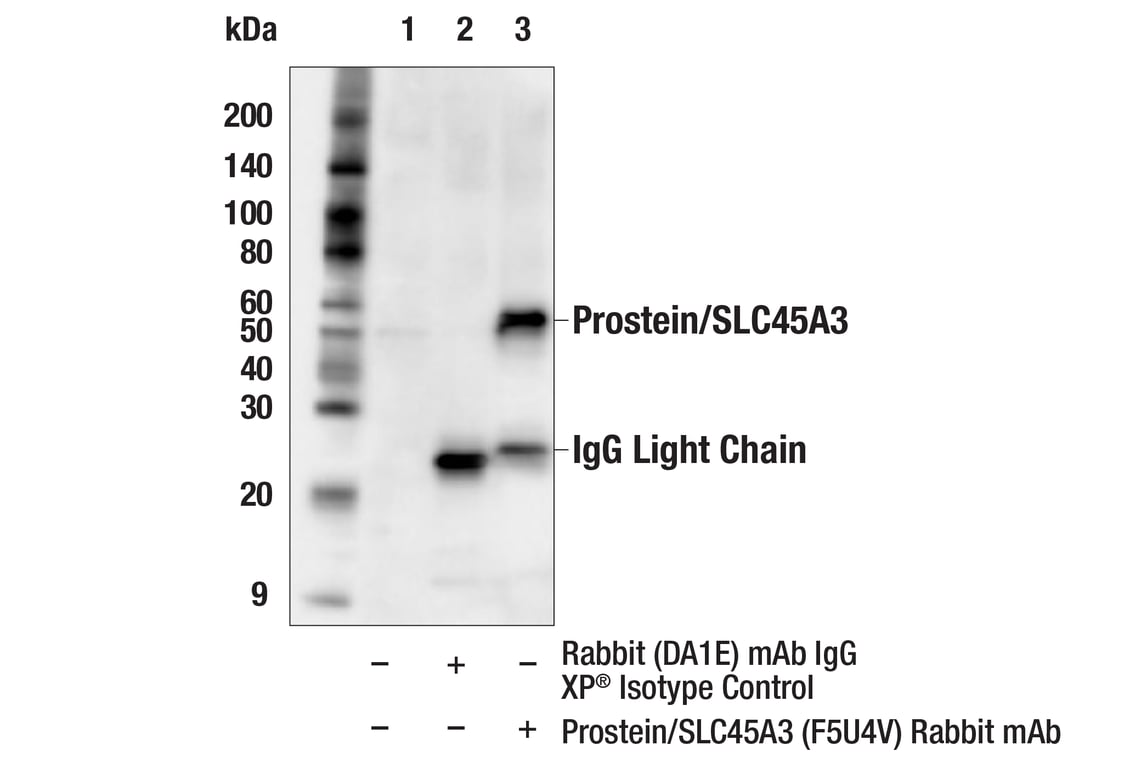 Immunoprecipitation Image 1: Prostein/SLC45A3 (F5U4V) Rabbit Monoclonal Antibody