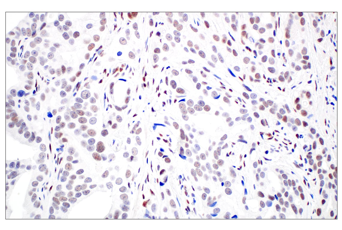 Immunohistochemistry Image 4: TCF12/HEB (E5R8X) Rabbit Monoclonal Antibody