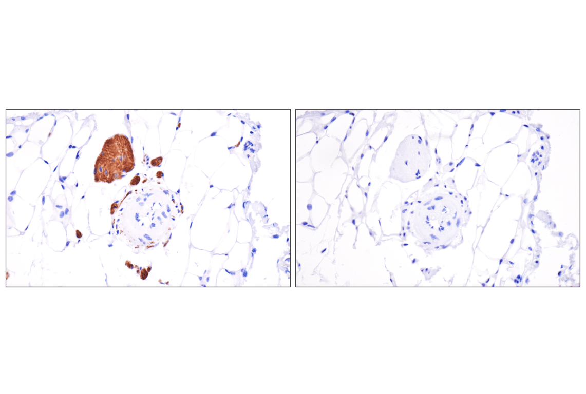 Immunohistochemistry Image 13: Phospho-Tau (Ser396) (F3S9T) Rabbit Monoclonal Antibody
