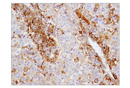 Immunohistochemistry Image 1: CD40 (D8W3N) Rabbit Monoclonal Antibody (BSA and Azide Free)