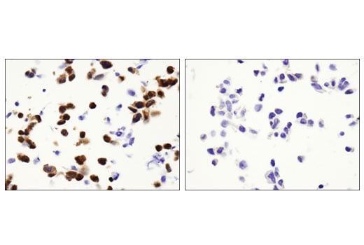 Immunohistochemistry Image 4: Akt1 (D9R8K) Rabbit Monoclonal Antibody