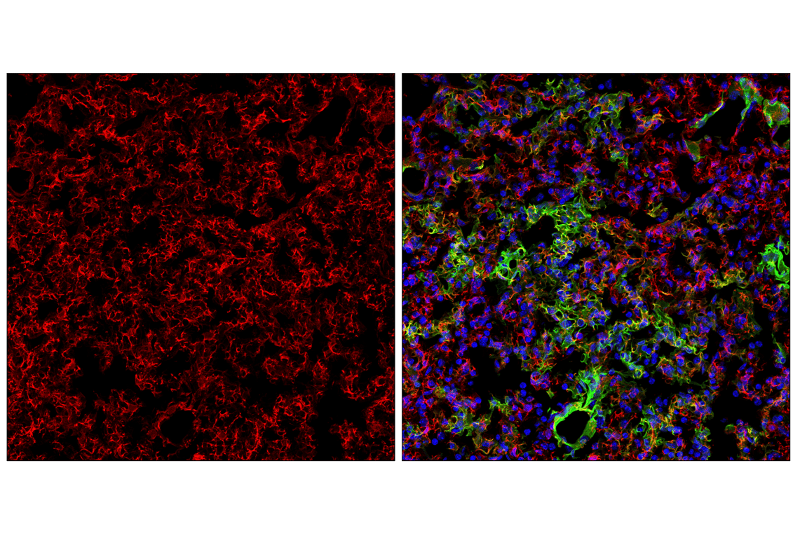undefined Image 91: Pericyte Antibody Sampler Kit