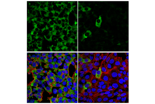 Immunofluorescence Image 1: YTHDF2 (E2I2H) Rabbit Monoclonal Antibody