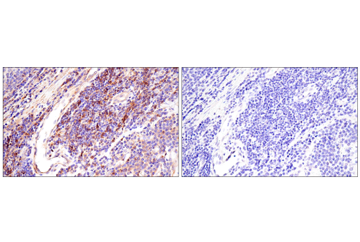 Immunohistochemistry Image 12: CD99 (PCB1) Mouse Monoclonal Antibody