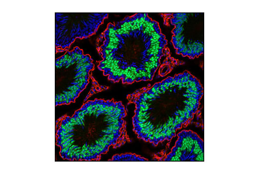 Immunofluorescence Image 1: NUT (C52B1) Rabbit Monoclonal Antibody (BSA and Azide Free)