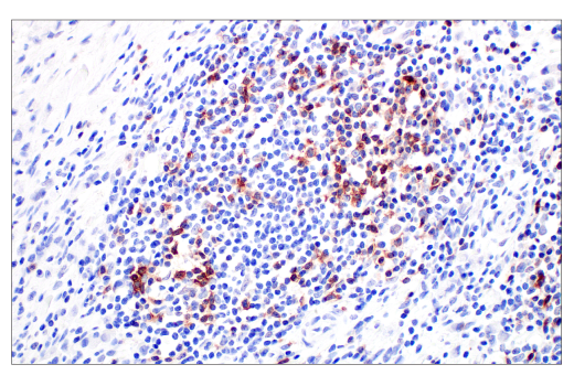 Immunohistochemistry Image 5: TIGIT (E5Y1W) Rabbit Monoclonal Antibody (BSA and Azide Free)