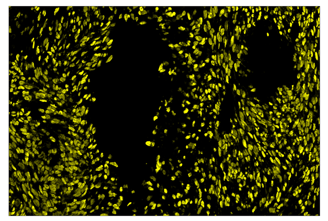 Immunohistochemistry Image 3: Sox10 (E6B6I) & CO-0080-647 SignalStar<sup>™</sup> Oligo-Antibody Pair