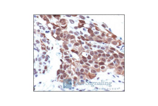 undefined Image 18: Phospho-PKC Antibody Sampler Kit