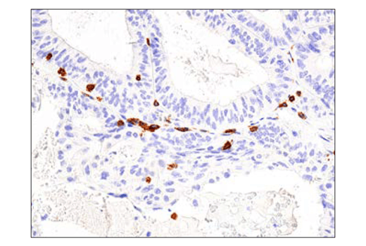 Immunohistochemistry Image 2: CD3 epsilon (D7A6E<sup>™</sup>) Rabbit Monoclonal Antibody