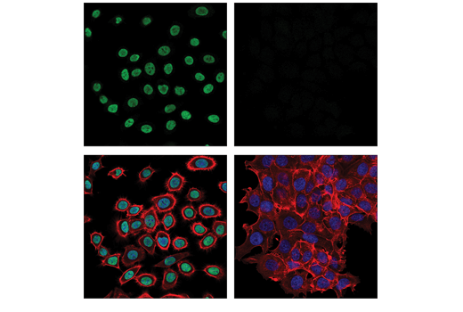 Immunofluorescence Image 1: DeltaN p63 (E6Q3O) Rabbit Monoclonal Antibody