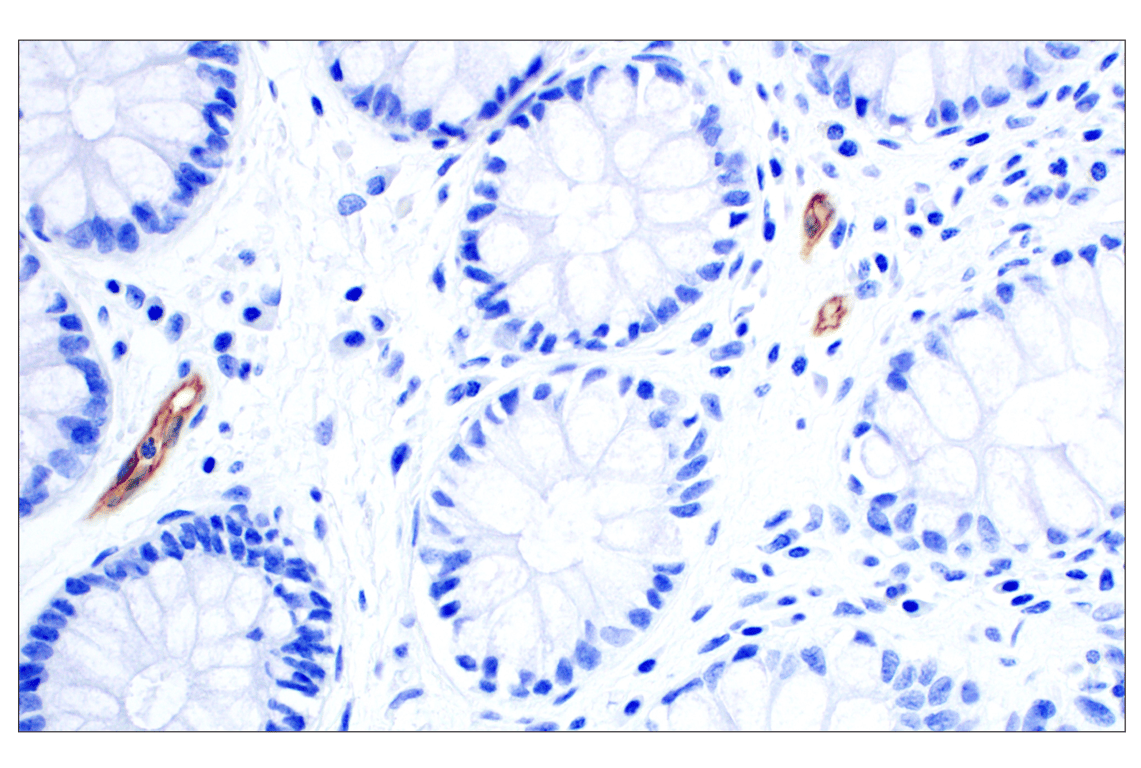 Immunohistochemistry Image 3: MAdCAM-1 (E1V8F) Rabbit Monoclonal Antibody (BSA and Azide Free)
