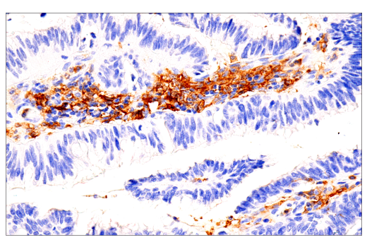 Immunohistochemistry Image 2: GM-CSF Receptor alpha (E8Z3S) Rabbit Monoclonal Antibody