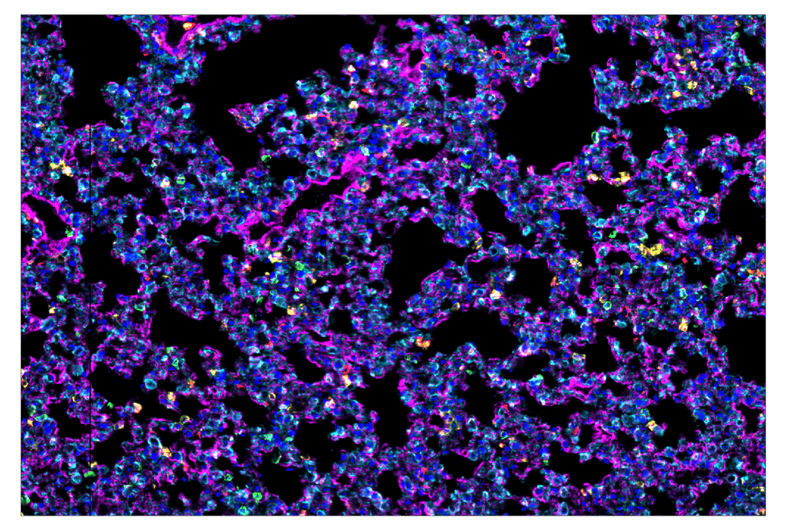 Immunohistochemistry Image 1: CD39/NTPDase 1 (E2X6B) & CO-0076-488 SignalStar<sup>™</sup> Oligo-Antibody Pair