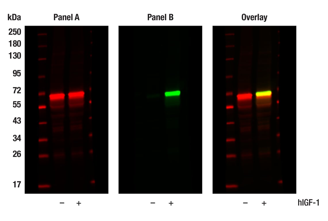 undefined Image 31: Phospho-Akt Isoform Antibody Sampler Kit