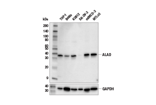Western Blotting Image 2: ALAD (E8Z7Y) Rabbit Monoclonal Antibody
