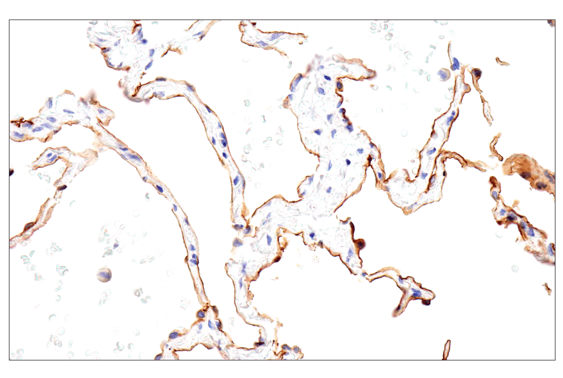 Immunohistochemistry Image 4: Folate Receptor Alpha/FOLR1 (BN3.2) Mouse mAb