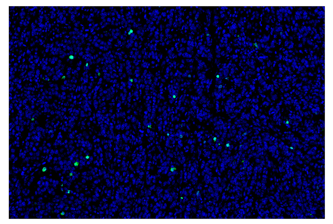 Immunohistochemistry Image 2: Cleaved PARP (Asp214) (D6X6X) & CO-0136-488 SignalStar<sup>™</sup> Oligo-Antibody Pair