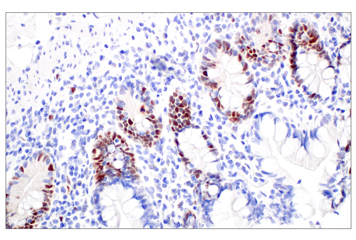 Immunohistochemistry Image 8: BRCA1 (E5S9G) Rabbit Monoclonal Antibody