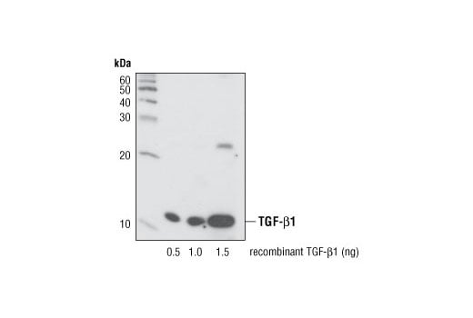 undefined Image 3: Cancer-associated Growth Factor Antibody Sampler Kit