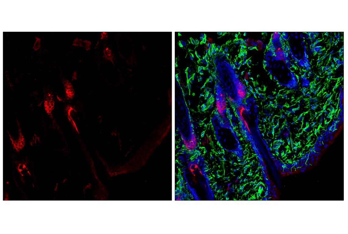 Immunofluorescence Image 2: Pan-Keratin (C11) Mouse Monoclonal Antibody (Alexa Fluor<sup>®</sup> 647 Conjugate)