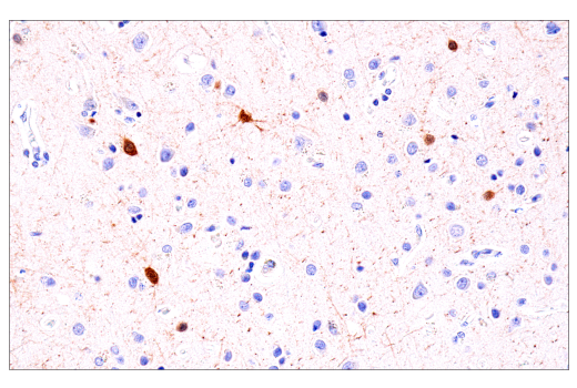Immunohistochemistry Image 1: Parvalbumin (E8N2U) Rabbit Monoclonal Antibody (BSA and Azide Free)