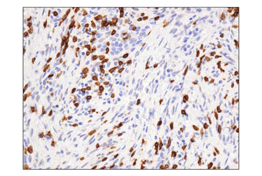 Immunohistochemistry Image 1: CD3 epsilon (D7A6E<sup>™</sup>) Rabbit Monoclonal Antibody (BSA and Azide Free)