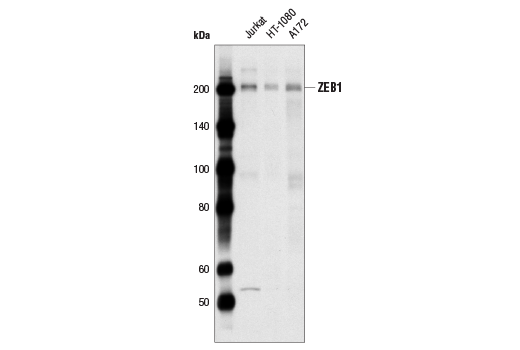 undefined Image 18: Epithelial-Mesenchymal Transition (EMT) Antibody Sampler Kit