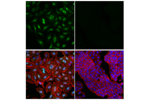 Immunofluorescence Image 2: Glucocorticoid Receptor (D6H2L) Rabbit Monoclonal Antibody