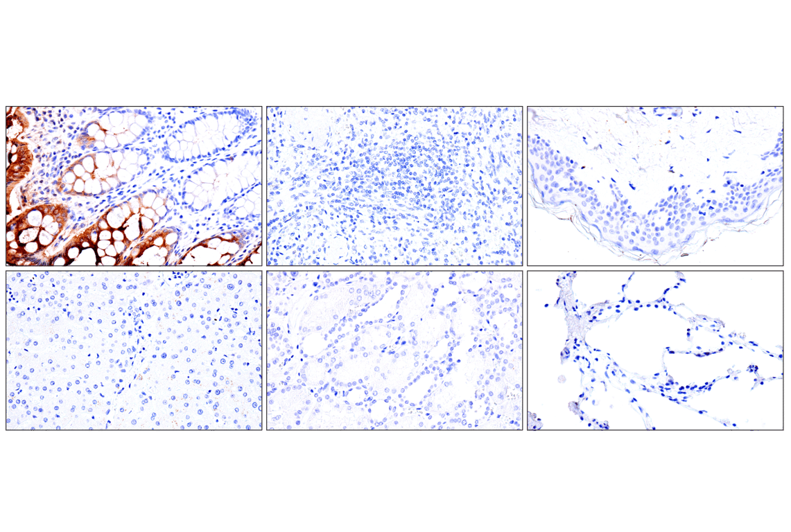 Immunohistochemistry Image 8: CEACAM7 (E5Q6X) Rabbit Monoclonal Antibody (BSA and Azide Free)