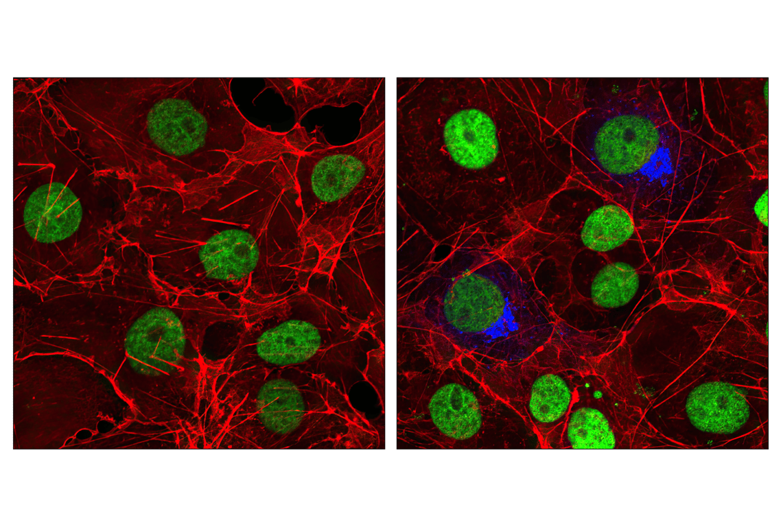 Immunofluorescence Image 1: HA-Tag (6E2) Mouse mAb (Alexa Fluor<sup>®</sup> 647 Conjugate)