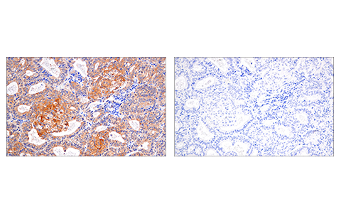 Immunohistochemistry Image 6: RIP (E8S7U) Rabbit Monoclonal Antibody (BSA and Azide Free)