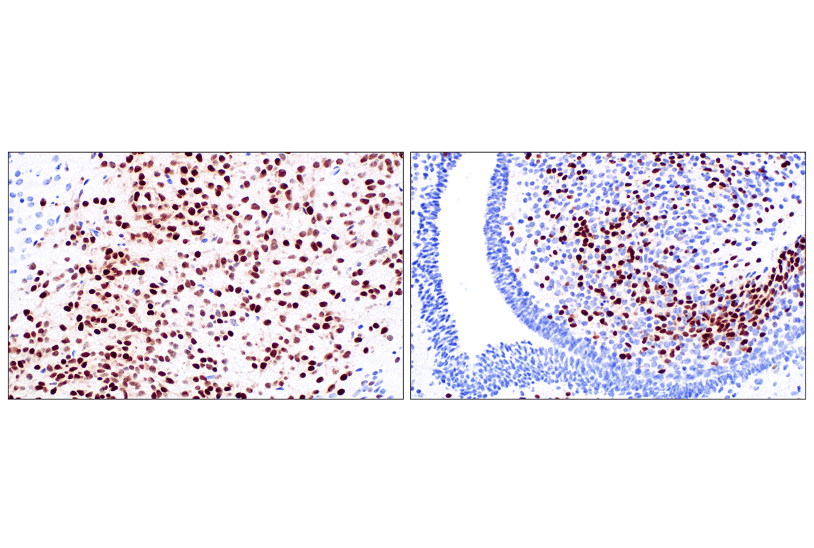 Immunohistochemistry Image 2: SIX3 (F1I1S) Rabbit Monoclonal Antibody