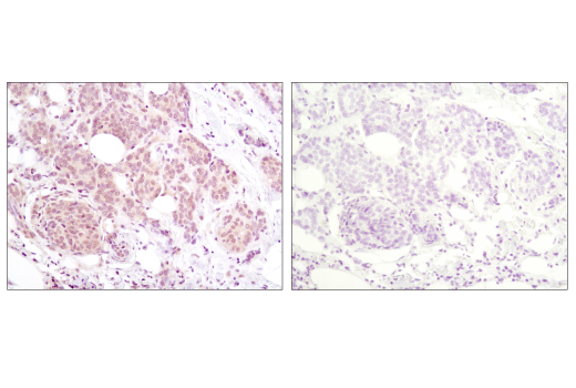 Immunohistochemistry Image 1: Akt (pan) (40D4) Mouse Monoclonal Antibody (BSA and Azide Free)