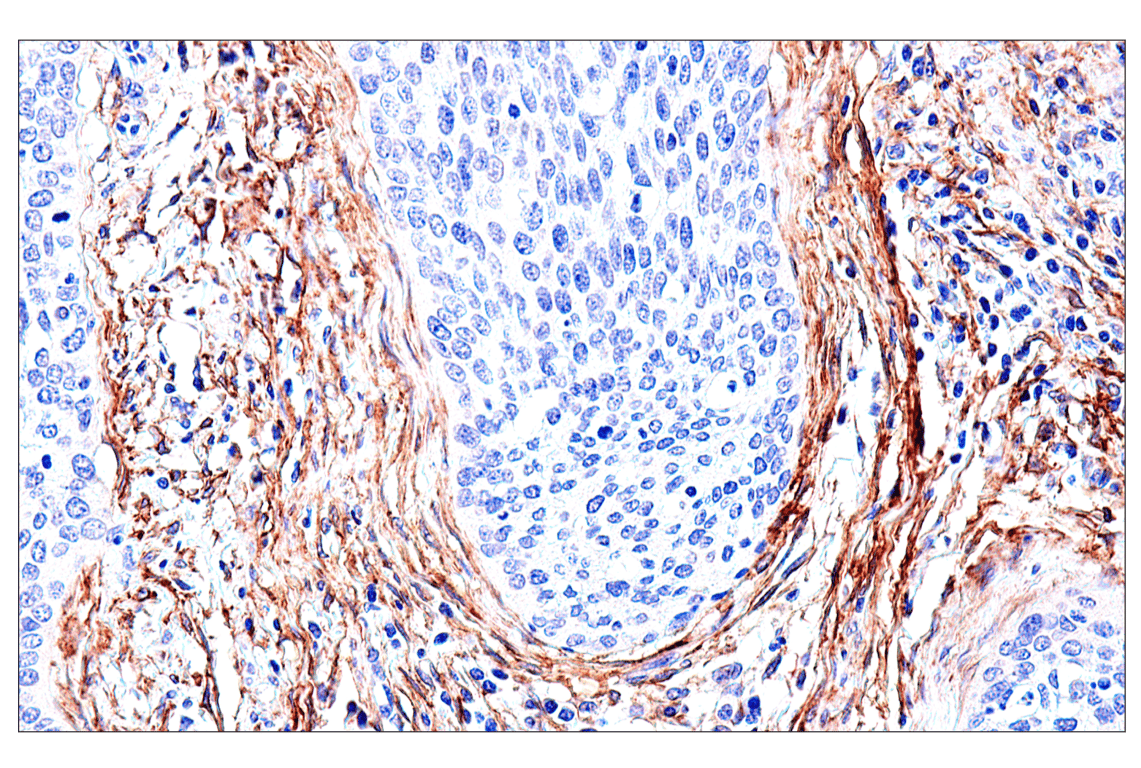 Immunohistochemistry Image 9: FAP (F1A4G) Rabbit Monoclonal Antibody (BSA and Azide Free)