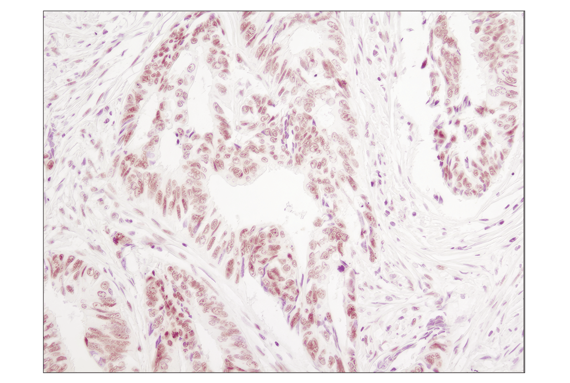 undefined Image 13: Angiogenesis Antibody Sampler Kit