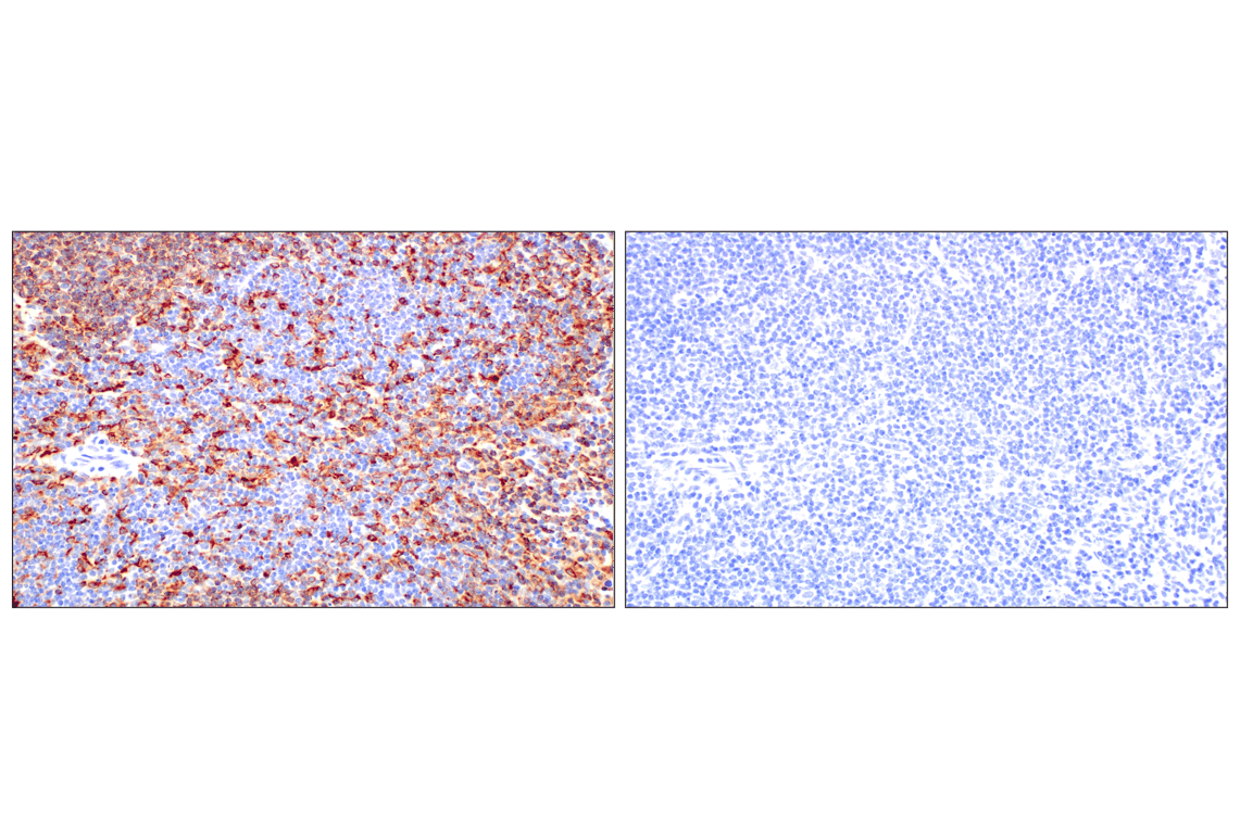 Immunohistochemistry Image 8: CD74 (F3R3L) Rabbit Monoclonal Antibody