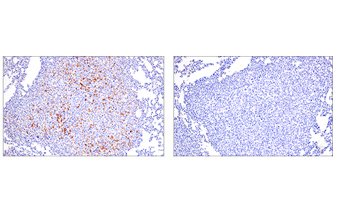 Immunohistochemistry Image 1: PD-L2 (D6L5A) Rabbit Monoclonal Antibody