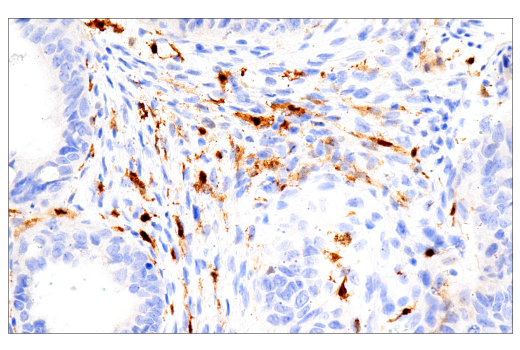Immunohistochemistry Image 3: Factor XIIIA (E980.1) Mouse Monoclonal Antibody