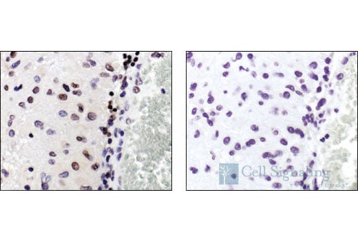 Immunohistochemistry Image 3: Phospho-p38 MAPK (Thr180/Tyr182) (12F8) Rabbit Monoclonal Antibody