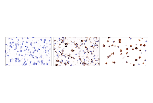 Immunohistochemistry Image 1: 4-1BB/CD137/TNFRSF9 (E2J5H) Rabbit Monoclonal Antibody