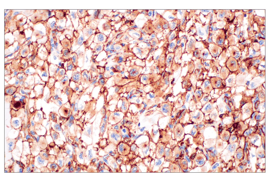 Immunohistochemistry Image 3: NT5E/CD73 (D7F9A) Rabbit Monoclonal Antibody