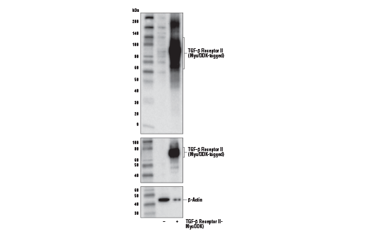 Western Blotting Image 2: TGF-beta Receptor II Antibody