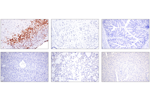 Immunohistochemistry Image 2: Cas9 (<i>S. pyogenes</i>) (E7M1H) Rabbit Monoclonal Antibody