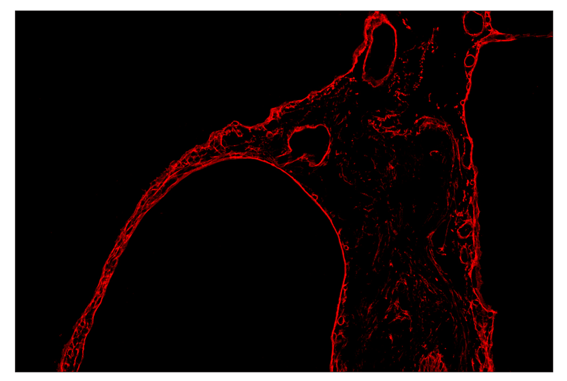 Immunohistochemistry Image 4: COL1A1 (E8F4L) & CO-0106-488 SignalStar<sup>™</sup> Oligo-Antibody Pair