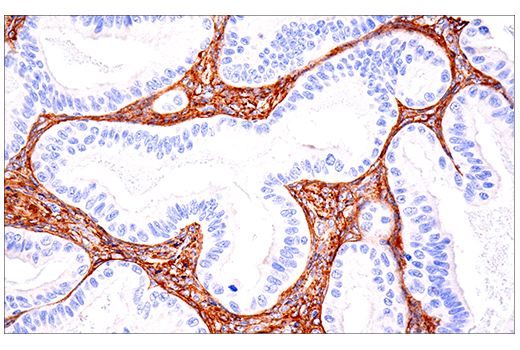 Immunohistochemistry Image 3: COL1A1 (E3E1X) Mouse Monoclonal Antibody