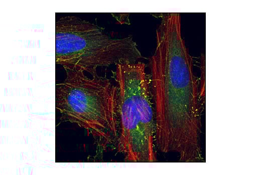 Immunofluorescence Image 1: Cortactin (H222) Antibody