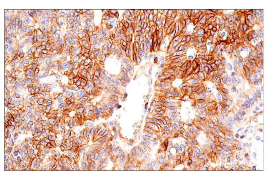 Immunohistochemistry Image 1: CD99 (PCB1) Mouse mAb