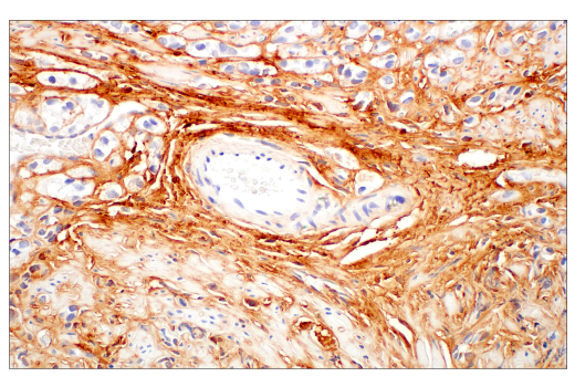 Immunohistochemistry Image 1: COL14A1 (E5W8S) Rabbit Monoclonal Antibody (BSA and Azide Free)